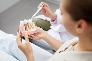 dental implant illustration
