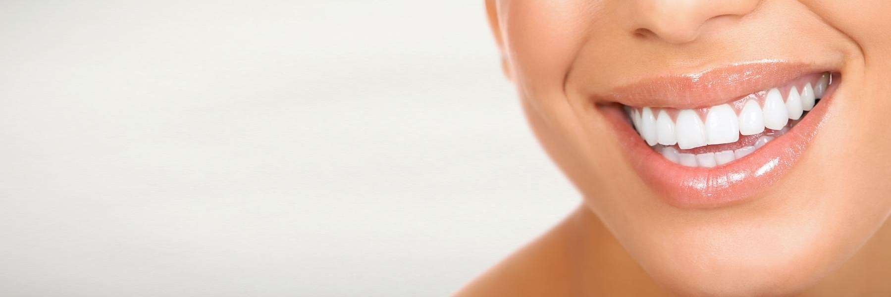 porcelain veneers in Evansville, IN