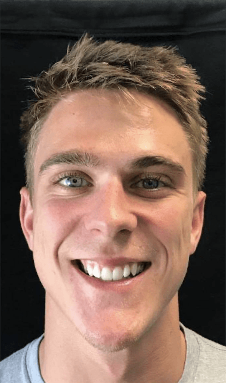slightly crooked front teeth