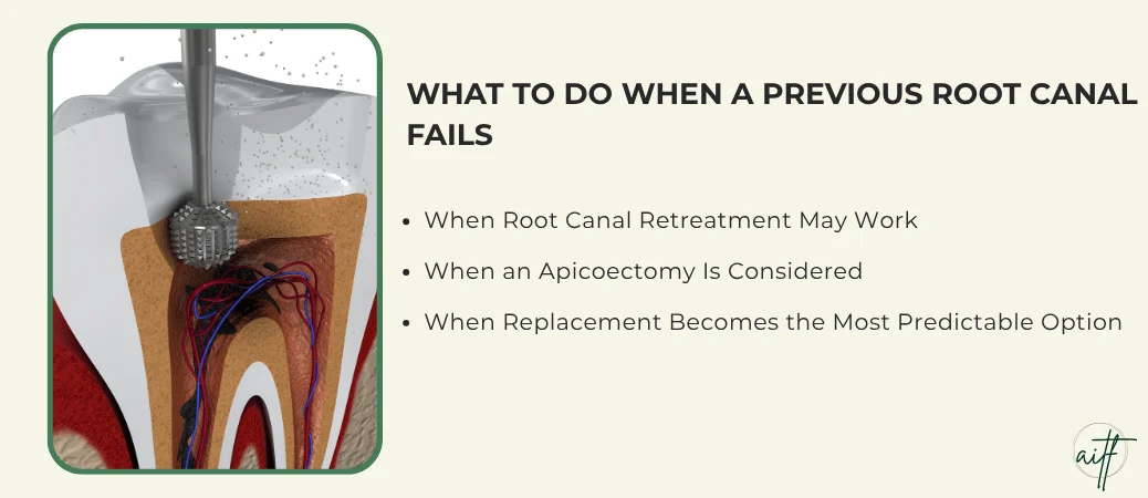 Options When a Previous Root Canal Has Failed