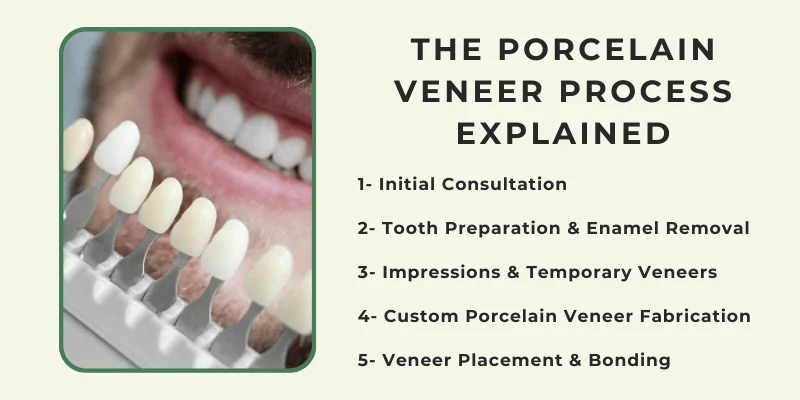 Alt text: porcelain-veneers-procedure-step-by-step