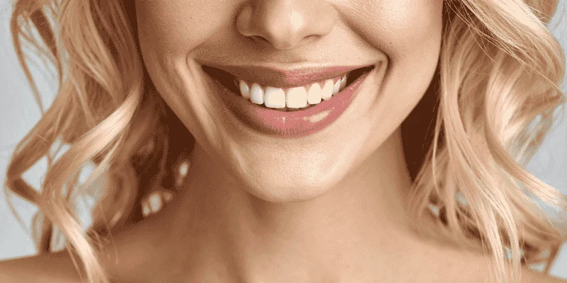 Smile Makeover Combinations
