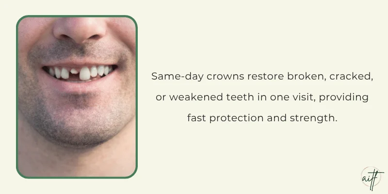 Types of Dental Injuries Requiring Crowns
