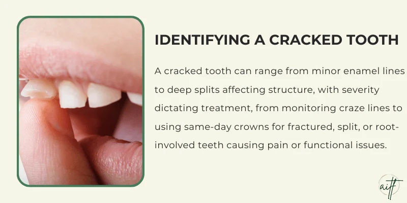 What Qualifies as a Cracked Tooth