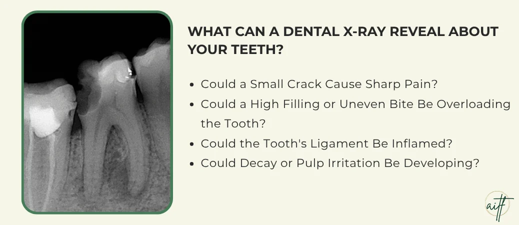 Which Tooth Problems Can Hide on an X-Ray