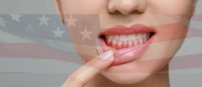 gum disease prevalence in U.S. adults