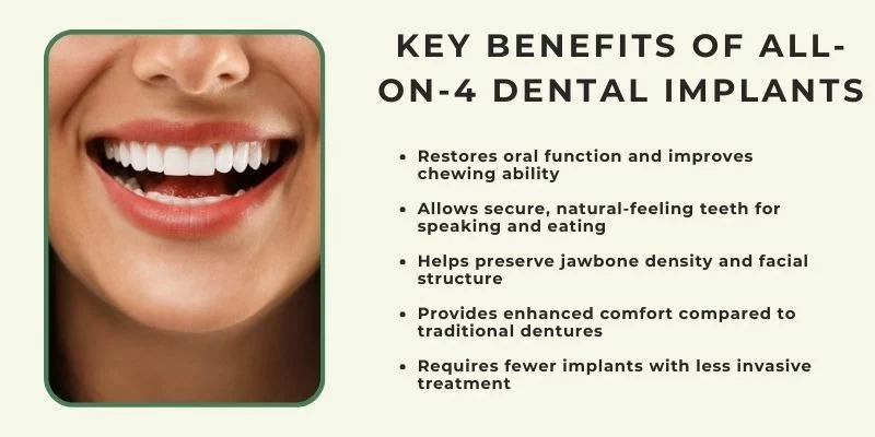 Key Benefits of All-on-4 Dental Implants