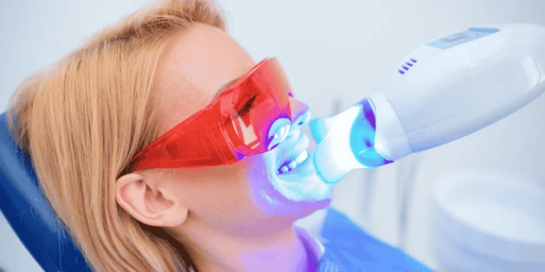repeat professional teeth whitening