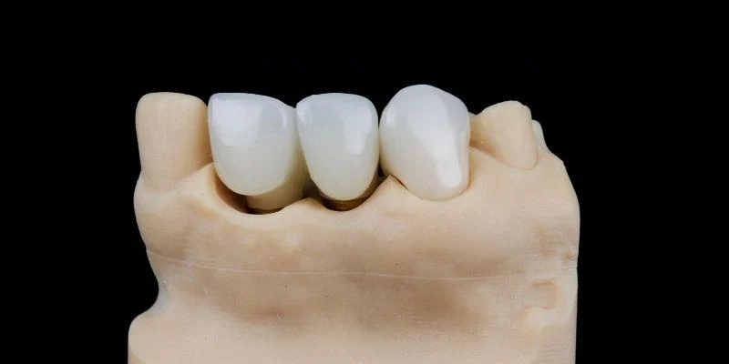 same day crown appearance