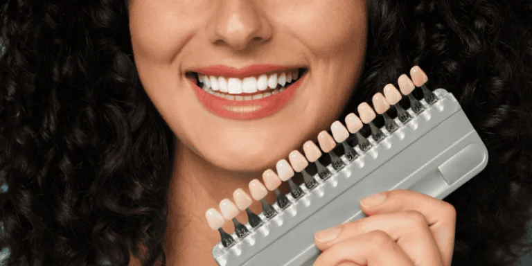 veneers for crooked teeth